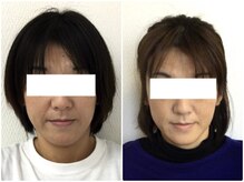 美容整体ウェリナ 名駅院/小顔矯正/骨盤矯正/美脚サロン