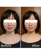 テマモリ(temamori)/施術ビフォーアフター