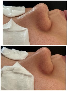 ロイジエ(Loyijie.w)/