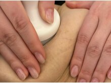 メルシー サロン(Merci Salon)/蓄積されたお腹の贅肉撃退！