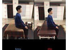 ストレチックス 近江八幡店/慢性腰痛に悩んでいる男性