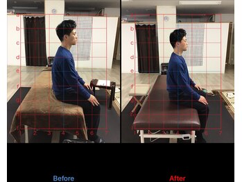 ストレチックス 近江八幡店/慢性腰痛に悩んでいる男性