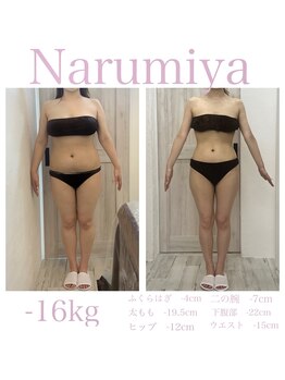 トータルチェンジエステ ナルミヤ(total change esthe Narumiya)の写真/◆初めての方大歓迎◆トータルチェンジプロデュース!あなたに合わせたオーダーメイド施術で理想のBodyに♪
