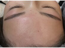 デュカ(Duca)/フェイシャルWAX　after