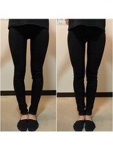 骨盤ストレッチ整体 b/Ｏ脚が気になる方オススメ