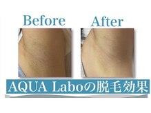 アクアラボ(AQUA Labo)/高い脱毛力