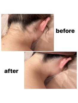 リーベ(Liebe×RNJ)/背中美人は脱毛から☆