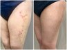【美脚メイク】むくみもピーマン尻も！下半身絞り上げ痩身ケア50分