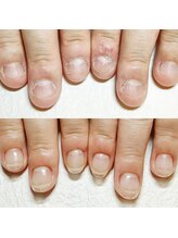 マニエネイル(mani e nail)/【深爪矯正】長さ出し/Clear