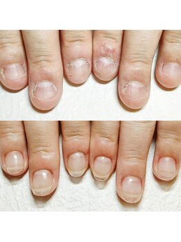 マニエネイル(mani e nail)/【深爪矯正】長さ出し/Clear