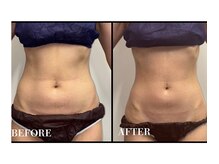 アイリーボーテ 東大阪(アイリーBEAUTE)の雰囲気(【痩身】お腹くびれコース 施術時間/30分)