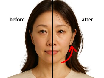 ニュートラル 渋谷店(NEUTRAL)/半顔矯正【小顔矯正】