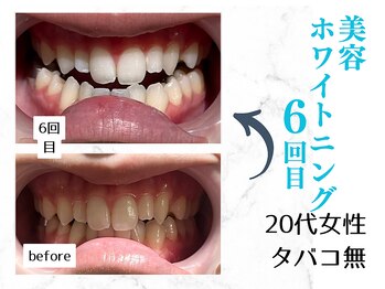 ルカノン(le canon)/写真を撮るのが楽しみです!(^^)!