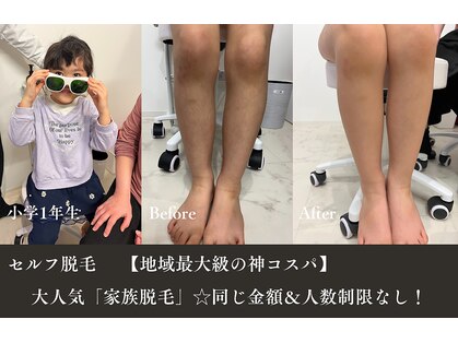 ココブルーム 小松店(Coco Bloom)の写真