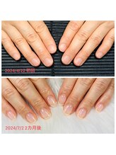 ココネ(cocone)/自爪育成 