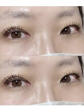 アイラッシュプラン リノ(eyelash plan RINO)/韓国風パーマ