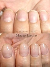 マリーロール 梅田店(Marie Laure)/自爪育成/深爪矯正/ネイルケア