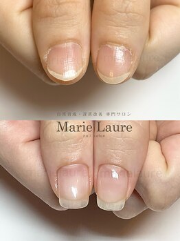 マリーロール 淀屋橋本店(Marie Laure)/深爪矯正/自爪風/自爪育成