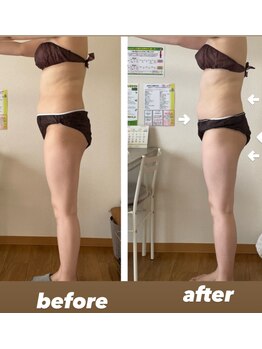 ヨサパーク メリー(YOSA PARK merry)/極上プレミアムコース一回目