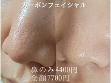 ラブミリア(LOVEMIRIA)の雰囲気（鼻のみメニュー可能。開き毛穴、凹凸が気になる方にオススメ!!）