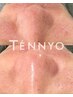 肌育毛穴洗浄（TENNYO） 【鼻、頬、顎】部分￥10,890→¥8.800