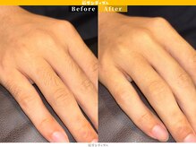 眉ダンディズム 大阪天神橋六丁目店/指毛before/After