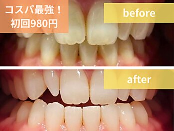 ボディアーキ 松山店(BODY ARCHI)/