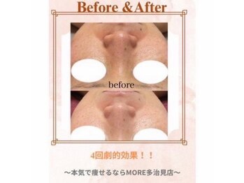 モア 多治見店(MORE)/お客様ビフォーアフター♪