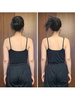 テマモリ(temamori)/施術ビフォーアフター