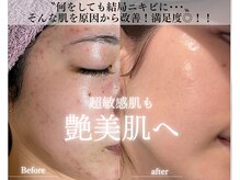 それぞれの肌にとって《美肌を保てる仕組み》から根本肌質改善！