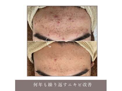 ワンモア(One MORE)の写真