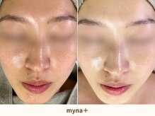 マイナプラ 表参道(myna+)/CHRISTINA/ILLUSTLIOUS