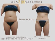 プレリー 自由が丘店/たった３回でここまで変わる