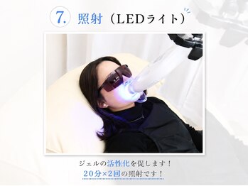 ホワイトニングサロン ホワイト 前橋店(WHITE)/7.照射
