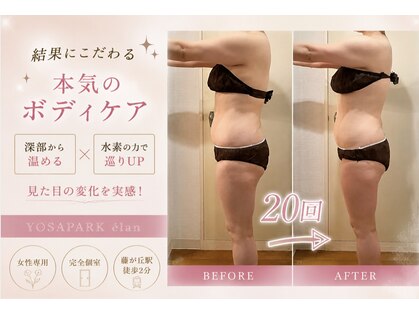 ヨサパーク エラン 藤が丘店(YOSA PARK elan)の写真