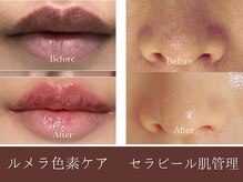 エイト(8)の雰囲気（韓国美容ルメラ・セラピール肌管理1回で黒ずみ・くすみリセット）