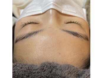 デュカ(Duca)/フェイシャルWAX　before