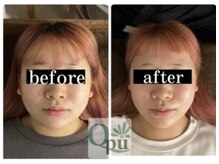 キュープ 名張店(Qpu)/オイルコース4回での変化