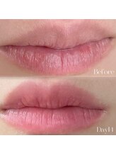 ビュエル(Beauel)/2週間後