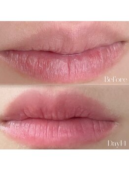 ビュエル(Beauel)/2週間後