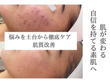 エミマス ボーテ(Emimas Beaute’)