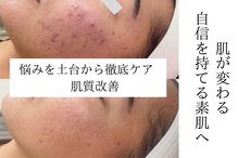 エミマス ボーテ(Emimas Beaute’)