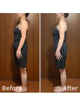 テマモリ(temamori)/施術ビフォーアフター