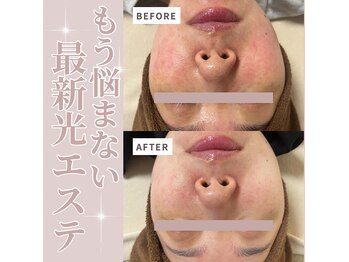 サロンモア(salon More)