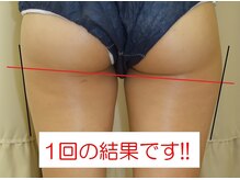 ドゥ リアンボーテキャビン/しっかり体感できます!!
