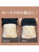 フラットベリー 恵比寿(Flat BELLY)/腸セラピー90分/1回