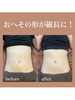 フラットベリー 恵比寿(Flat BELLY)/腸セラピー90分/1回