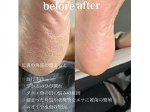 サロン ド ネイル 椿(Salon de nail 椿)の雰囲気（　最新！韓国式足裏角質ケア、エスプランニング！）