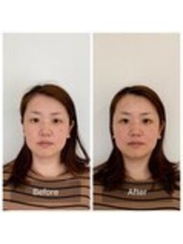 ハリラボ 仙台上杉店(hari Lab.)/【お客様の声】