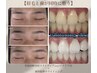 【回数券セット割】初回骨格診断美眉スタイリング(wax＋メイク付)3,500円